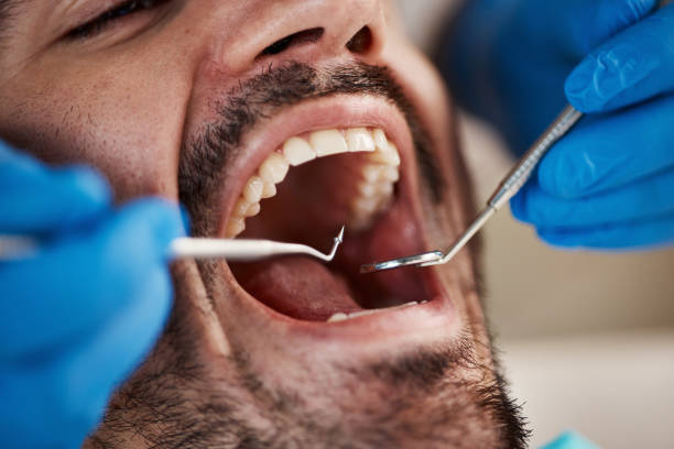 Best Emergency Treatment for Oral Infections in Lake Crystal, MN